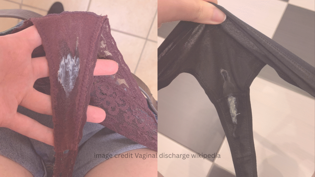 type of vaginal discharge